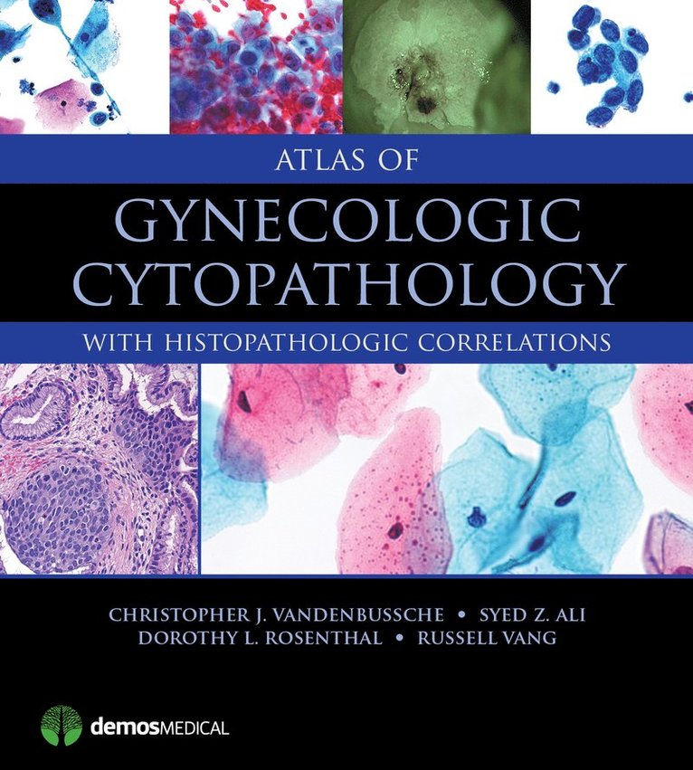Christopher J. VandenBussche, Syed Z. Ali, Dorothy L. Rosenthal, Russell Vang, Christopher J. Vandenbussche - Atlas of Gynecologic Cytopathology, Inbunden