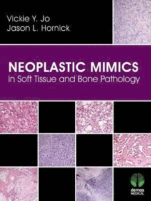 Vickie Y. Jo, Jason L. Hornick - Neoplastic Mimics in Soft Tissue and Bone Pathology, Inbunden