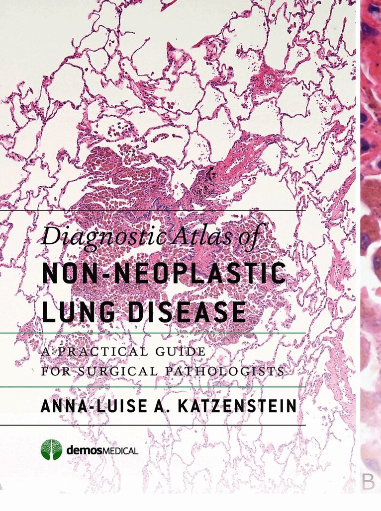 Diagnostic Atlas of Non-Neoplastic Lung Disease