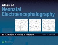 bokomslag Atlas of Neonatal Electroencephalography