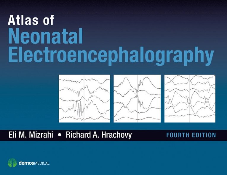 Eli M. Mizrahi, Richard A. Hrachovy, MD Mizrahi, Eli M., MD Hrachovy, Richard A., Eli M Mizrahi, Richard A Hrachovy - Atlas of Neonatal Electroencephalography, Inbunden