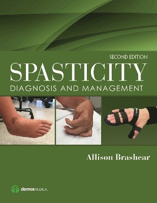 bokomslag Spasticity