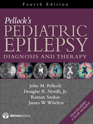 John M. Pellock, Douglas R. Nordli Jr., Raman Sankar, James W. Wheless - Pellock's Pediatric Epilepsy, Inbunden