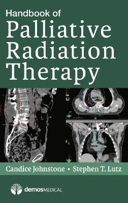 Handbook of Palliative Radiation Therapy 1