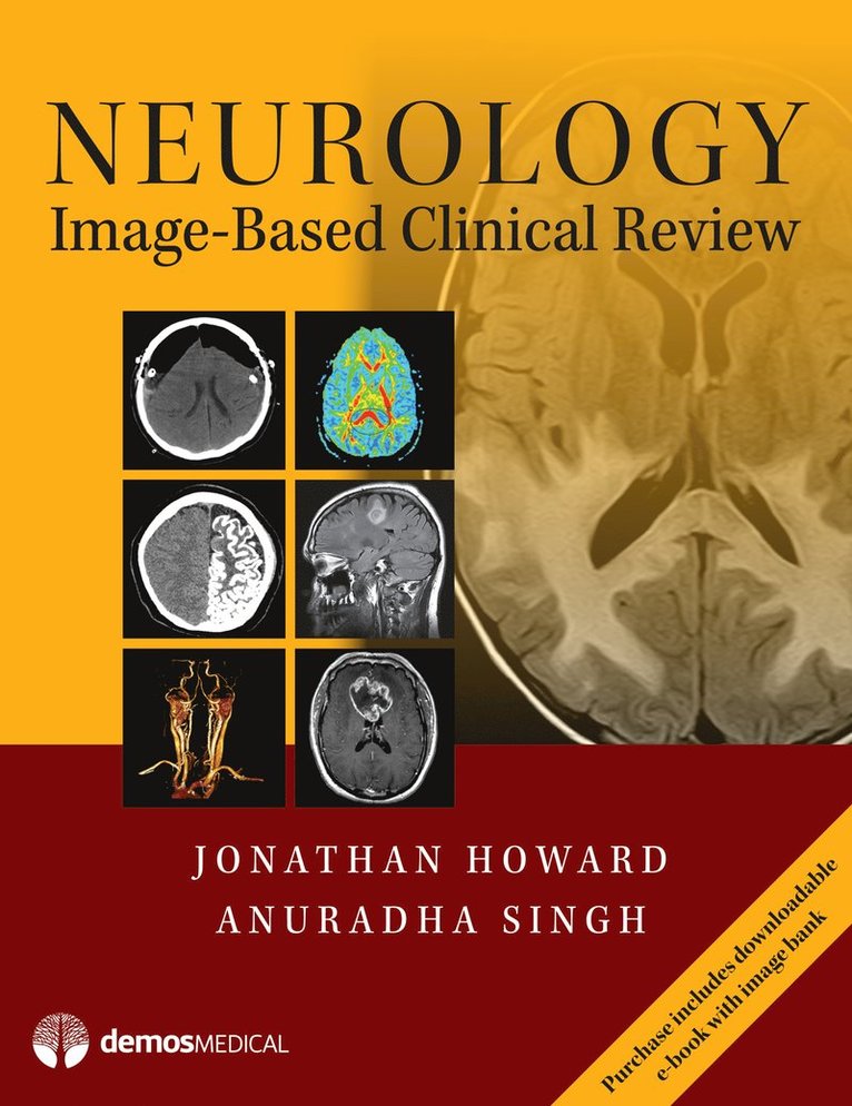 Jonathan Howard, Anuradha Singh, MD Howard, Jonathan, MD Singh, Anuradha - Neurology Image-Based Clinical Review, Häftad