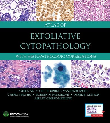 Syed Z. Ali, Christopher J. VandenBussche, Cheng-Ying Ho, Doreen N. Palsgrove, Derek Allison, Ashley Cimino-Mathews - Atlas of Exfoliative Cytopathology, Inbunden