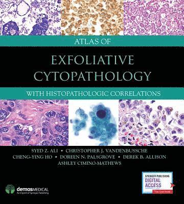Syed Z. Ali, Christopher J. VandenBussche, Cheng-Ying Ho, Doreen N. Palsgrove, Derek Allison, Ashley Cimino-Mathews, PhD VandenBussche, Christopher J., MD, MD Allison, Derek, Christopher J. Vandenbussche, FIAC Ali, Syed Z., MD, FRCPath, Syed Z Ali, Christopher J Vandenbussche, Doreen N Palsgrove - Atlas of Exfoliative Cytopathology, Inbunden