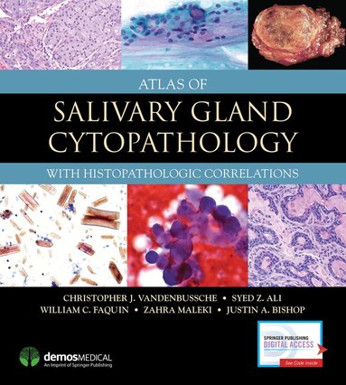 Christopher J. VandenBussche, Syed Z. Ali, William C. Faquin, Zahra Maleki, Justin Bishop - Atlas of Salivary Gland Cytopathology, Inbunden