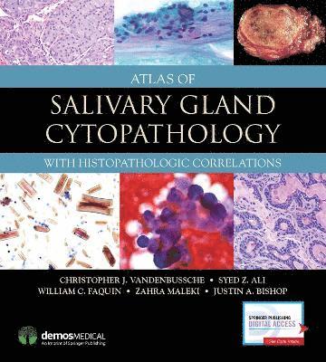 Atlas of Salivary Gland Cytopathology 1