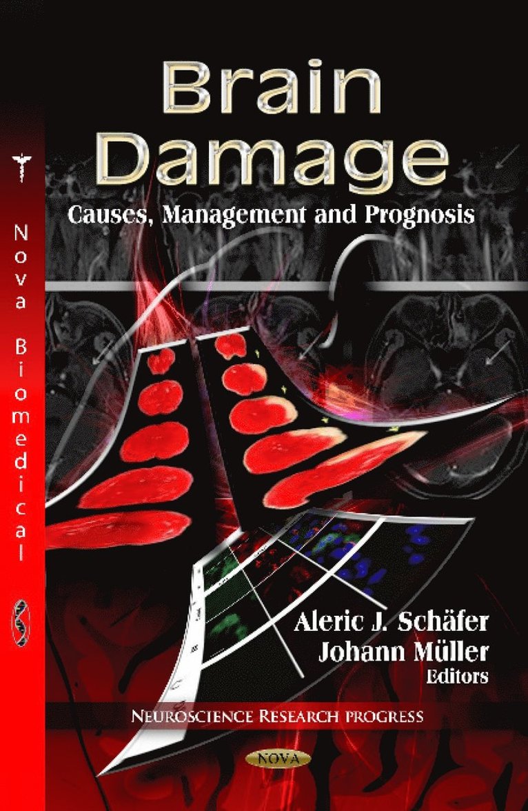 Aleric J Schäfer, Johann Müller, Aleric J Schafer, Johann Muller - Brain Damage, Inbunden