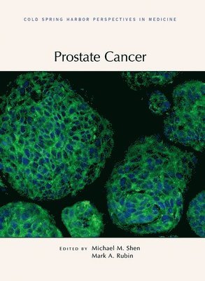 Michael Shen, Mark Rubin, Michael Shen, Mark Rubin - Prostate Cancer, Inbunden