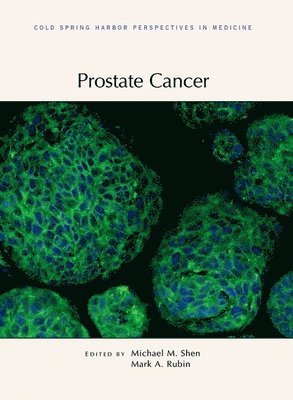 bokomslag Prostate Cancer