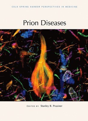 bokomslag Prion Diseases