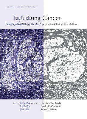 Lung Cancer 1