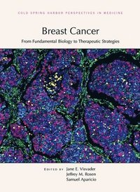 bokomslag Breast Cancer: From Fundamental Biology to Therapeutic Strategies