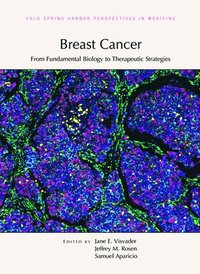 bokomslag Breast Cancer: From Fundamental Biology to Therapeutic Strategies