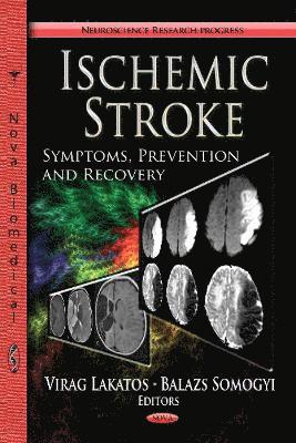 bokomslag Ischemic Stroke