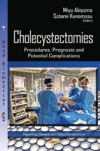 bokomslag Cholecystectomies