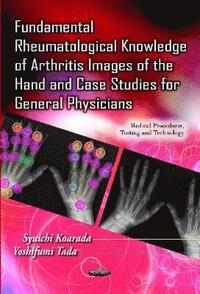 bokomslag Fundamental Rheumatological Knowledge of Arthritis Images of the Hand & Case Studies for General Physicians