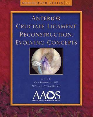 Anterior Cruciate Ligament Reconstruction