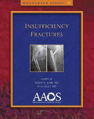 bokomslag Insufficiency Fractures