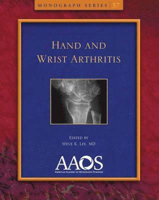 Hand and Wrist Arthritis