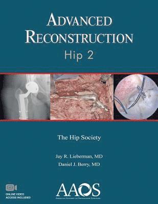Advanced Reconstruction: Hip 2
