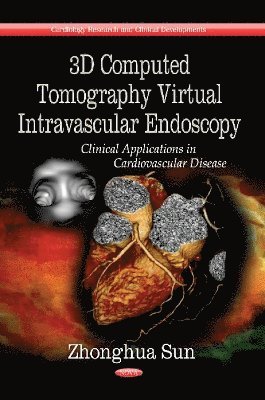 bokomslag 3D Computed Tomography Virtual Intravascular Endoscopy