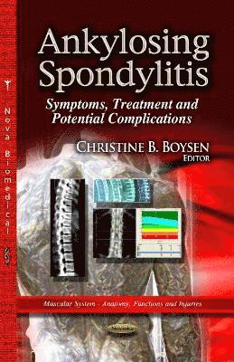 bokomslag Ankylosing Spondylitis