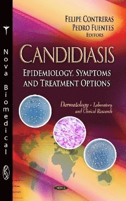 bokomslag Candidiasis