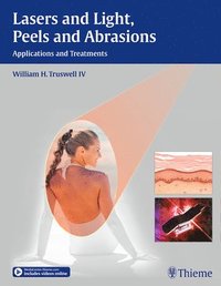 bokomslag Lasers and Light, Peels and Abrasions