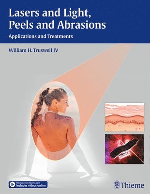 William H. Truswell, William H Truswell - Lasers and Light, Peels and Abrasions, Inbunden