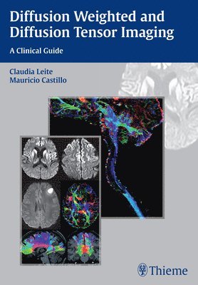 bokomslag Diffusion Weighted and Diffusion Tensor Imaging