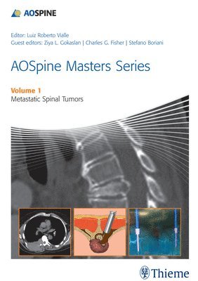 bokomslag AOSpine Masters Series Volume 1: Metastatic Spinal Tumors