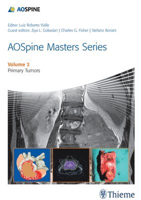 AOSpine Masters Series Volume 2: Primary Spinal Tumors 1