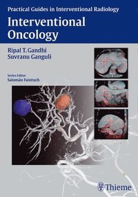 bokomslag Interventional Oncology