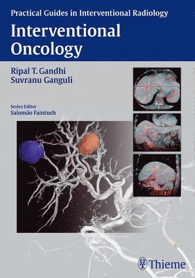 Interventional Oncology 1