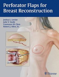 bokomslag Perforator Flaps for Breast Reconstruction