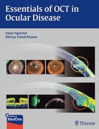 bokomslag Essentials of OCT in Ocular Disease