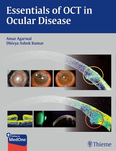 Amar Agarwal, Dhivya Ashok Kumar - Essentials of OCT in Ocular Disease, Inbunden