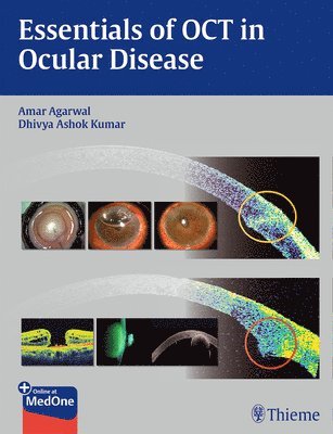 Essentials of OCT in Ocular Disease 1