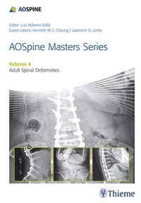 bokomslag AOSpine Master Series, Vol. 4: Adult Spinal Deformities