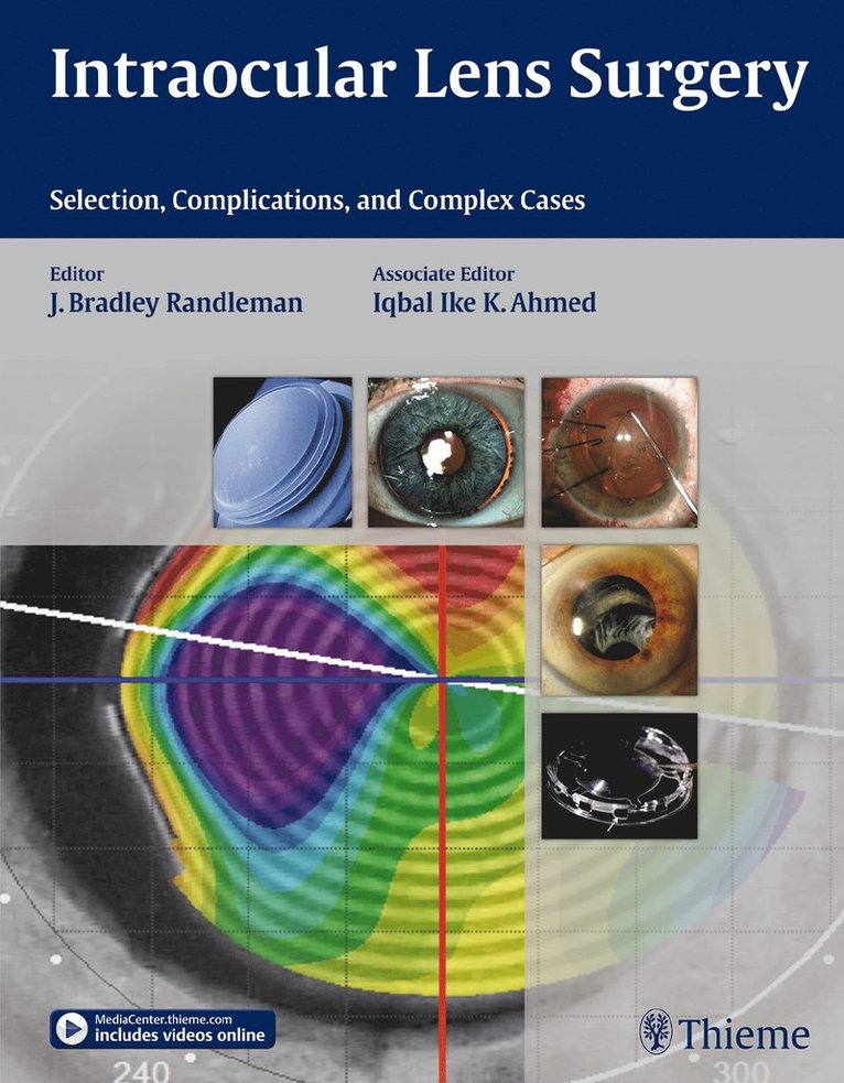 Bradley Randleman, Iqbal Ike K Ahmed, Iqbal Ike K. Ahmed - Intraocular Lens Surgery, Inbunden