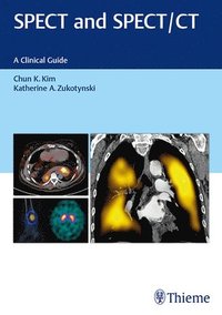 bokomslag SPECT and SPECT/CT