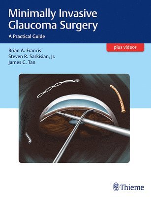 bokomslag Minimally Invasive Glaucoma Surgery
