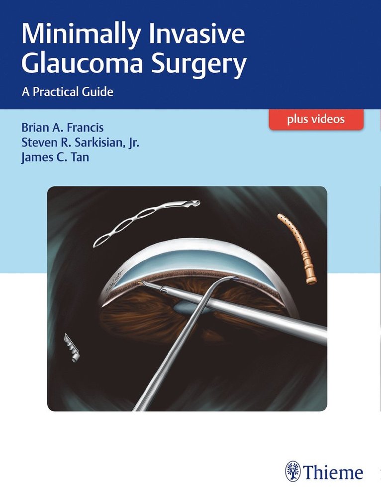 Brian Francis, Steven Sarkisian, James C. Tan, James C Tan - Minimally Invasive Glaucoma Surgery, Inbunden