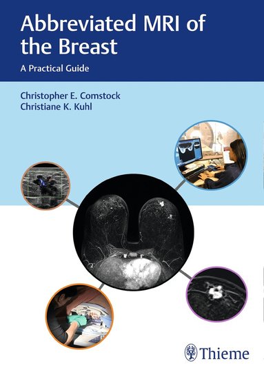 Christopher E. Comstock, Christiane Kuhl - Abbreviated MRI of the Breast, Inbunden