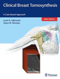 bokomslag Clinical Breast Tomosynthesis