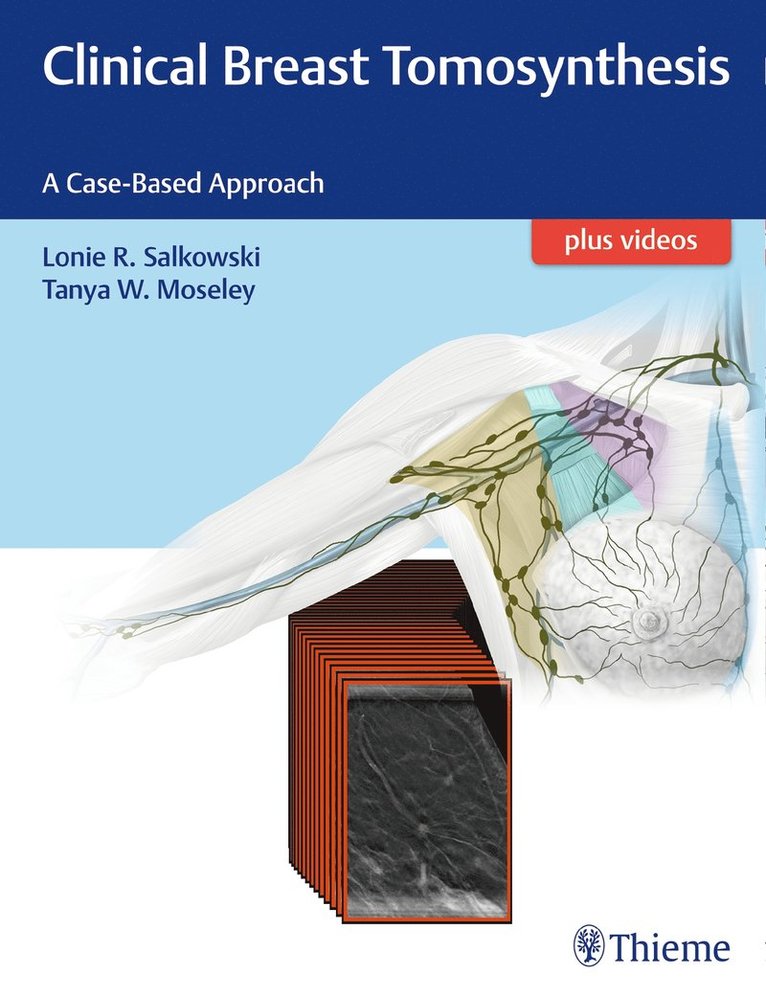 Clinical Breast Tomosynthesis 1