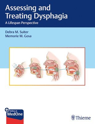 Assessing and Treating Dysphagia 1